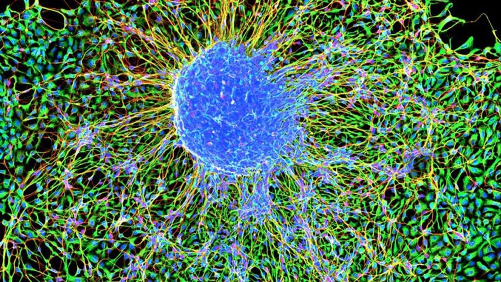 Para ilmuwan mengungkap matematika tersembunyi yang mengatur bagaimana neuron berkumpul di otak